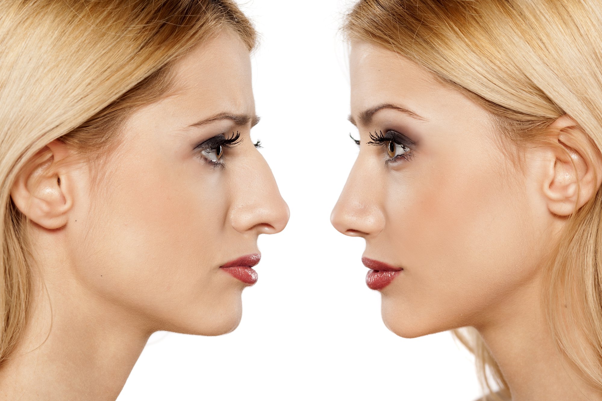 13 Tips To Speed Up Your Rhinoplasty Recovery Time Dr Farrior